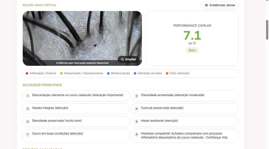 Laudo do TrichoSense com tricoscopia ampliada e score de performance capilar
